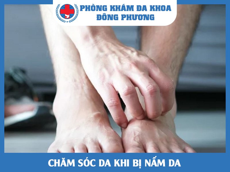 Chăm sóc da như thế nào?