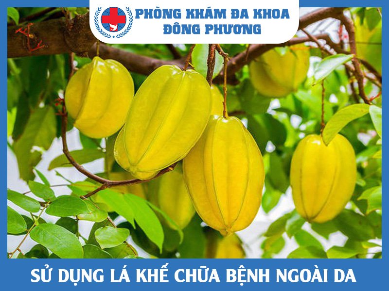 Chữa các bệnh ngoài da bằng lá khế