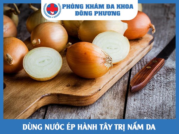 Chữa bệnh nấm da bằng nước ép hành tây